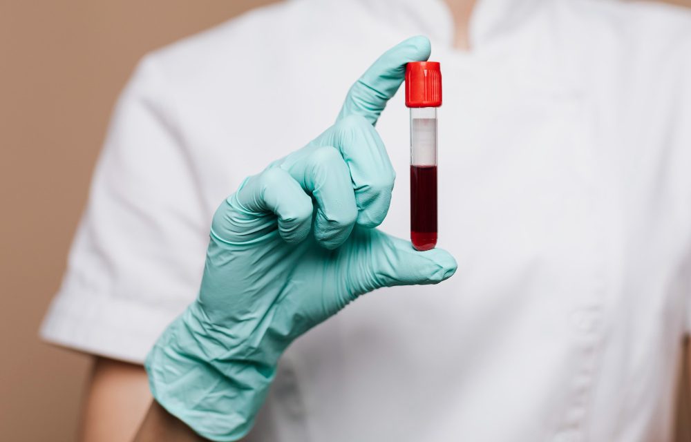 Prueba de sangre para detectar Alzheimer con 91% de precisión