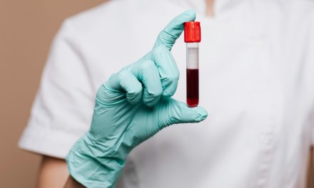 Prueba de sangre para detectar Alzheimer con 91% de precisión